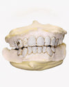 Custom Letter Moissanite Grillz - Yellow Gold