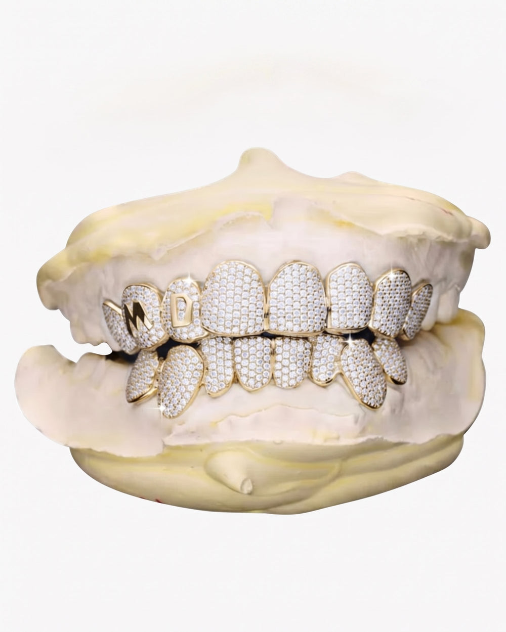 Custom Letter Moissanite Grillz - Yellow Gold