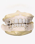 Custom Letter Moissanite Grillz - Yellow Gold