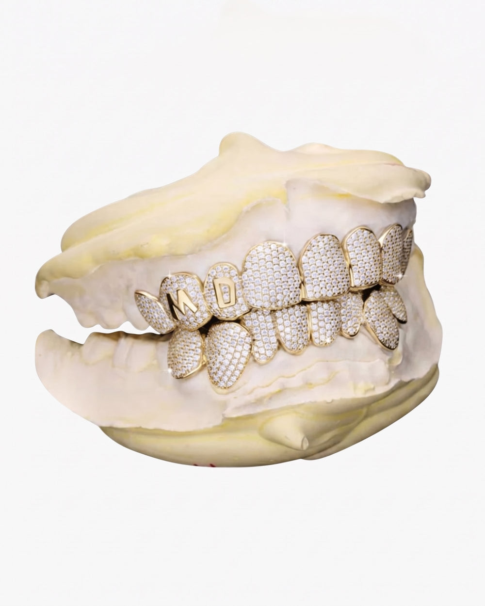 Custom Letter Moissanite Grillz - Yellow Gold