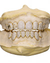 Custom Letter Moissanite Grillz - Yellow Gold