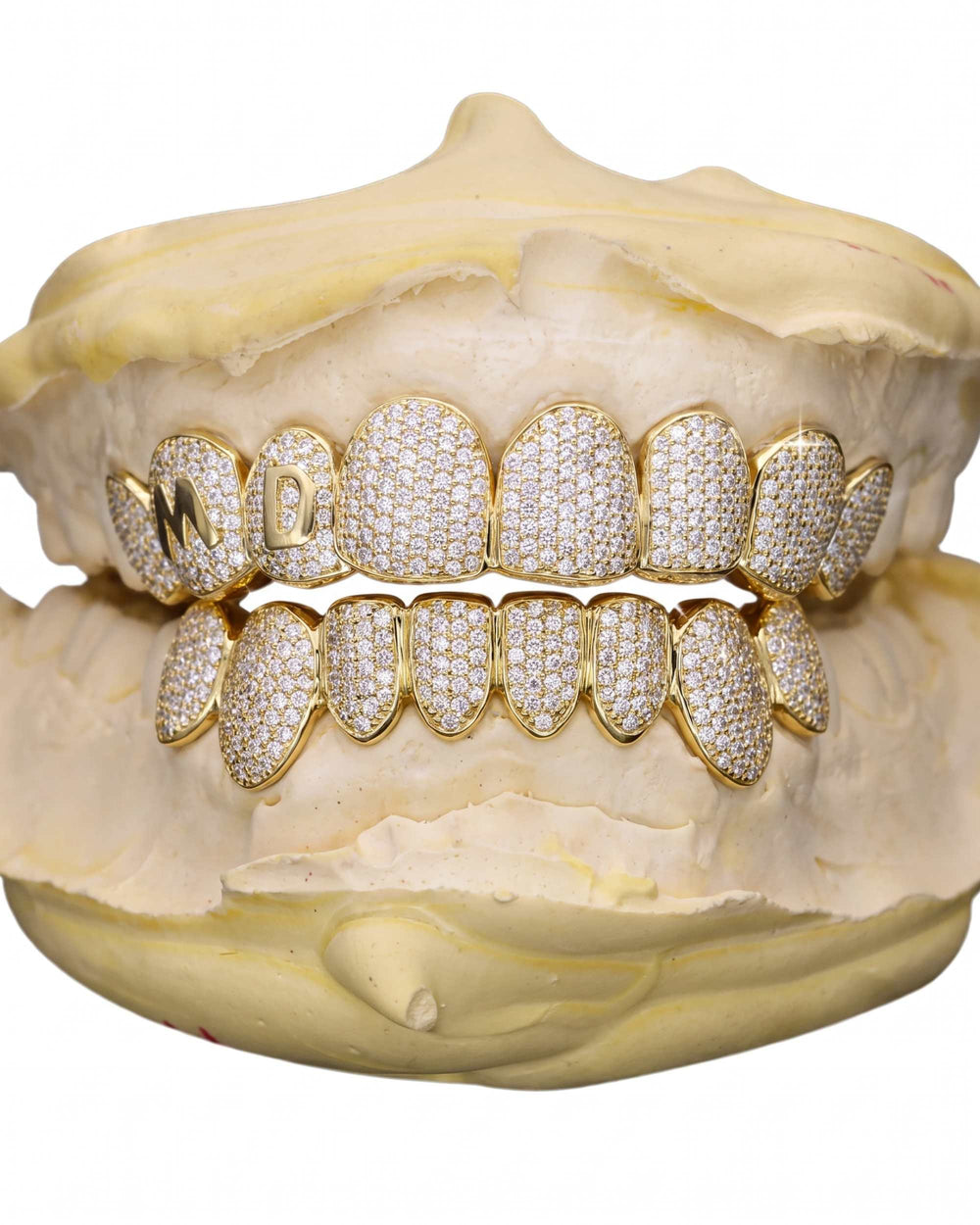 Custom Letter Moissanite Grillz - Yellow Gold