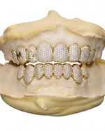 Custom Letter Moissanite Grillz - Yellow Gold