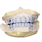 Custom Letter Moissanite Grillz - White Gold