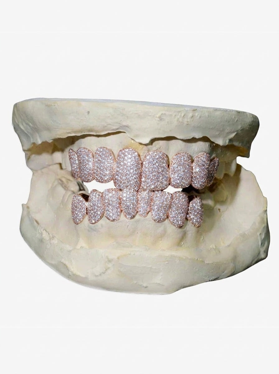 8 on 8 VVS Moissanite Diamond Grillz - Rose Gold