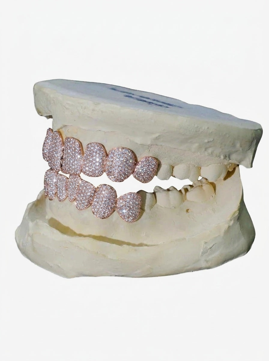 8 on 8 VVS Moissanite Diamond Grillz - Rose Gold