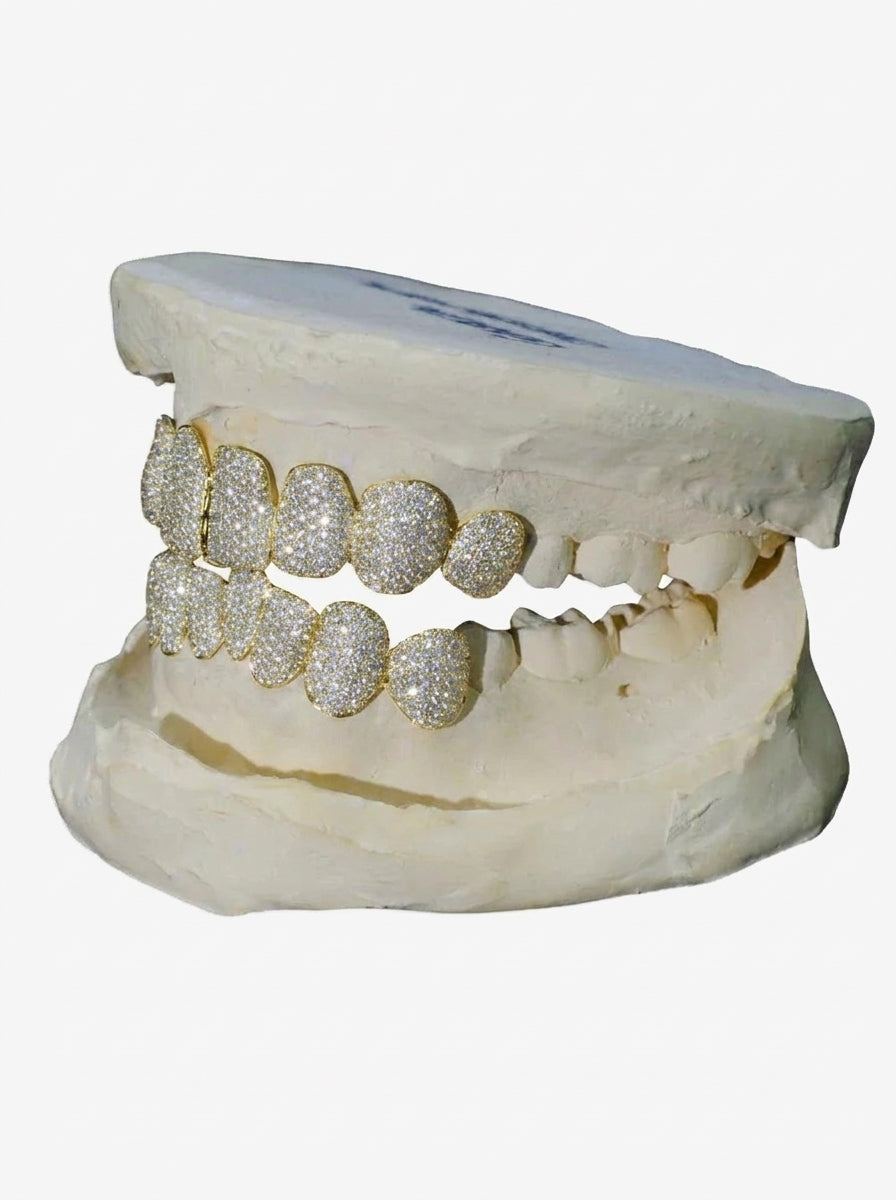 8 on 8 VVS Moissanite Diamond Grillz - Yellow Gold