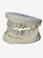 8 on 8 VVS Moissanite Diamond Grillz - Yellow Gold