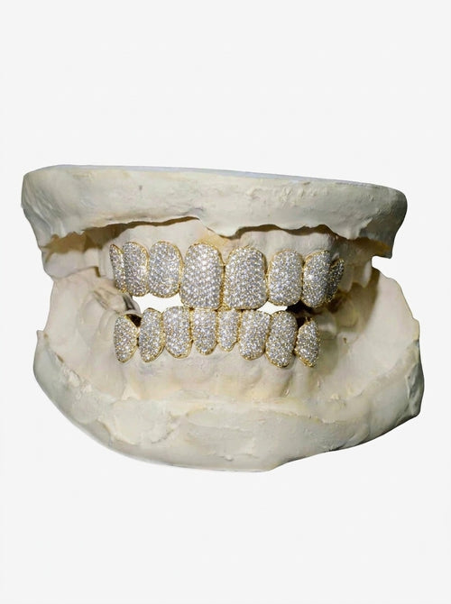 custom moissanite grillz ICECARTEL px yellow