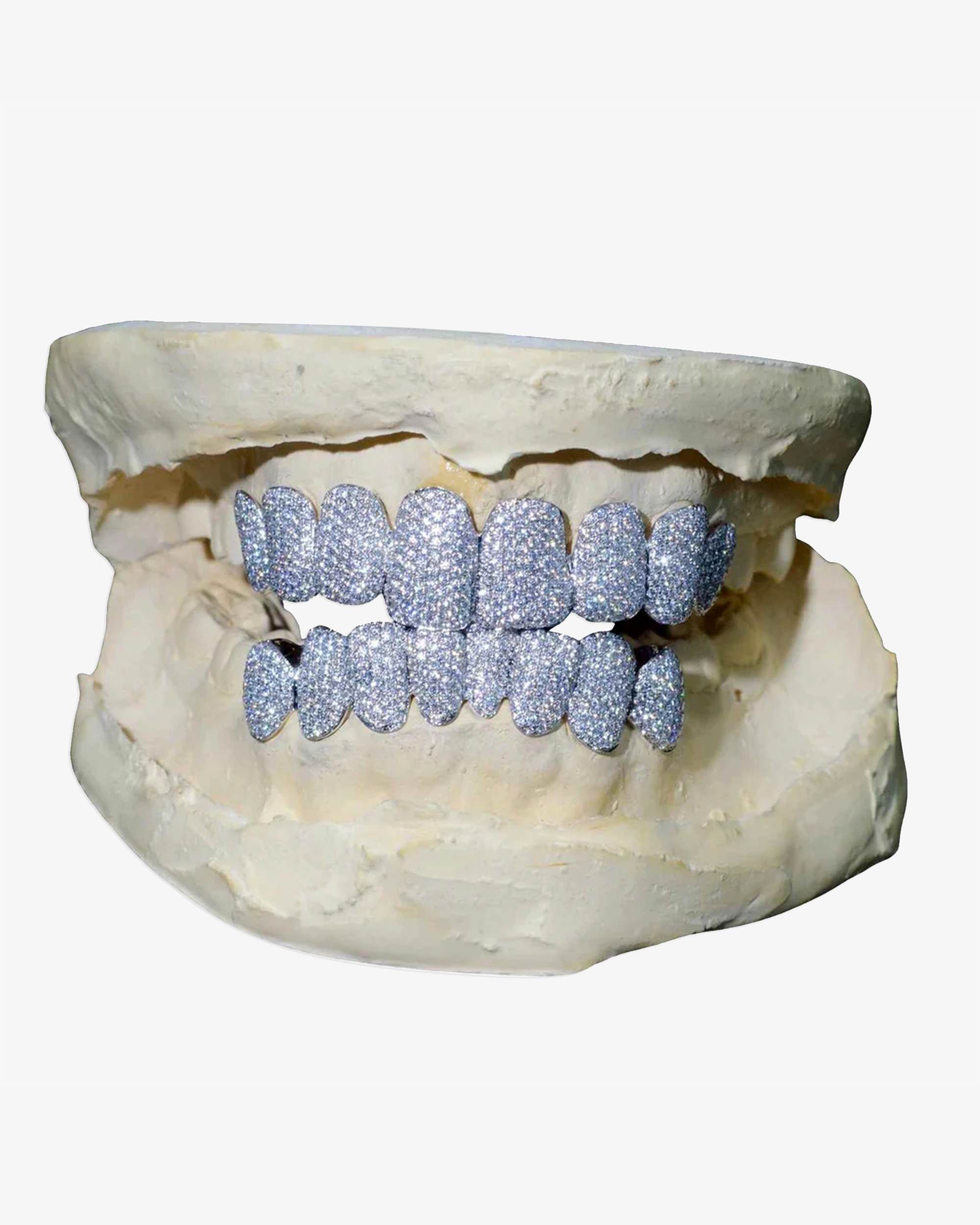 Grillz | Diamond, Gold, Sterling Silver, Gemstones