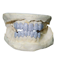 Custom Moissanite Grillz ICECARTEL
