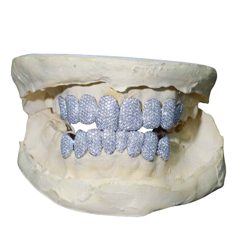 Custom Moissanite Grillz ICECARTEL