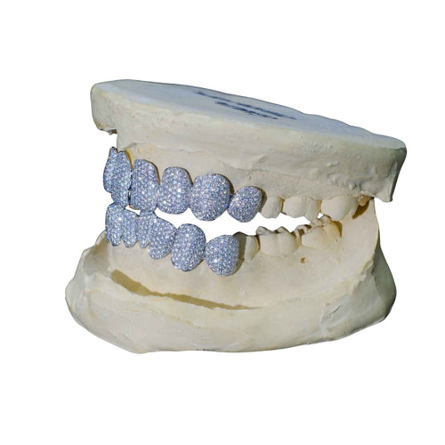 Custom Moissanite Grillz ICECARTEL