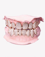 Custom Moissanite Cluster Grillz - Rose Gold
