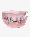 Custom Moissanite Opal Grillz - White Gold