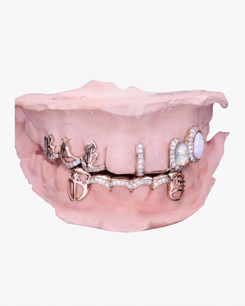 Custom Moissanite Opal Grillz - Rose Gold