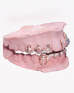 Custom Moissanite Opal Grillz - Rose Gold