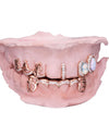 Custom Moissanite Opal Grillz - Rose Gold