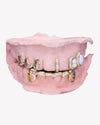 Custom Moissanite Opal Grillz - Yellow Gold