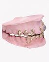 Custom Moissanite Opal Grillz - Yellow Gold
