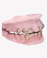 Custom Moissanite Opal Grillz - Yellow Gold