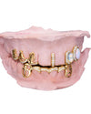 Custom Moissanite Opal Grillz - Yellow Gold