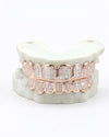 8 on 8 VVS Baguette Moissanite Diamond Grillz - Rose Gold