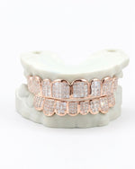 8 on 8 VVS Baguette Moissanite Diamond Grillz - Rose Gold