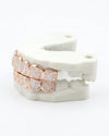 8 on 8 VVS Baguette Moissanite Diamond Grillz - Rose Gold