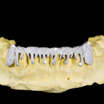 Moissanite Drippy Grillz 14K Gold - White Gold