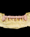Moissanite Drippy Grillz 14K Gold - Rose Gold