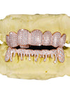 Moissanite Drippy Grillz 14K Gold - Rose Gold