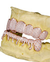 Moissanite Drippy Grillz 14K Gold - Rose Gold