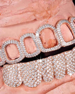Open Face Moissanite Grillz - Rose Gold