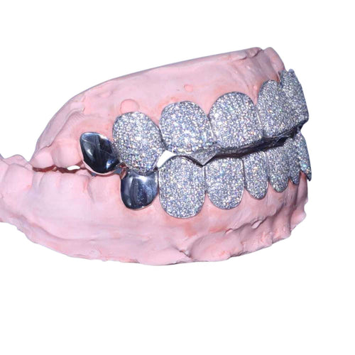 Plain Tusk Custom Diamond Grillz 14k Gold side icecartel