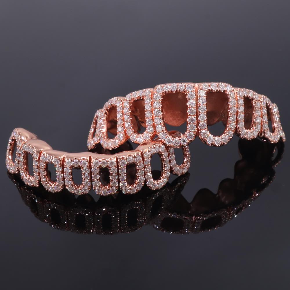 Rose Gold Custom Diamond open face grillz detailed