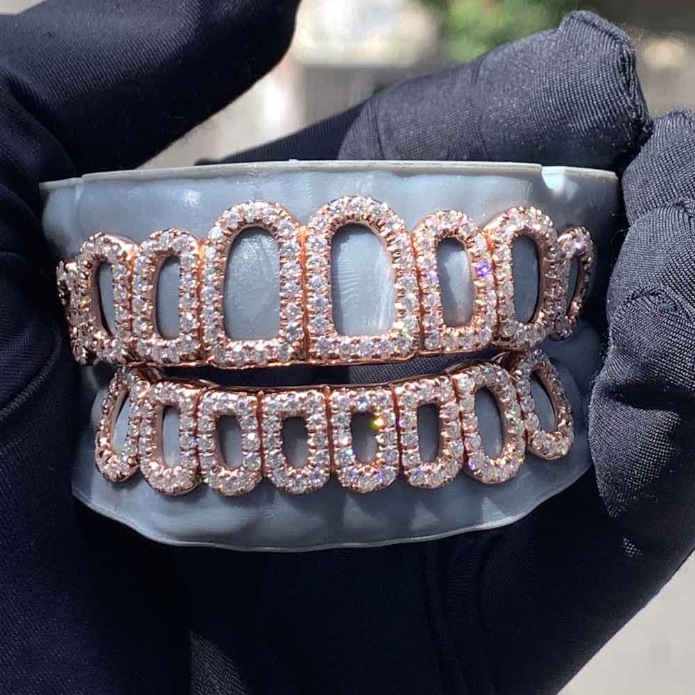 Rose Gold Custom Diamond open face grillz sunlight