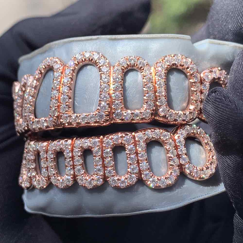 Rose Gold Custom Diamond open face grillz sunlight from the side