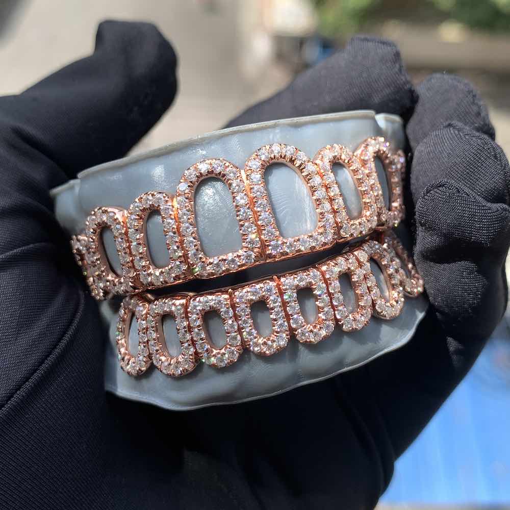 Rose Gold Custom Diamond open face grillz hand