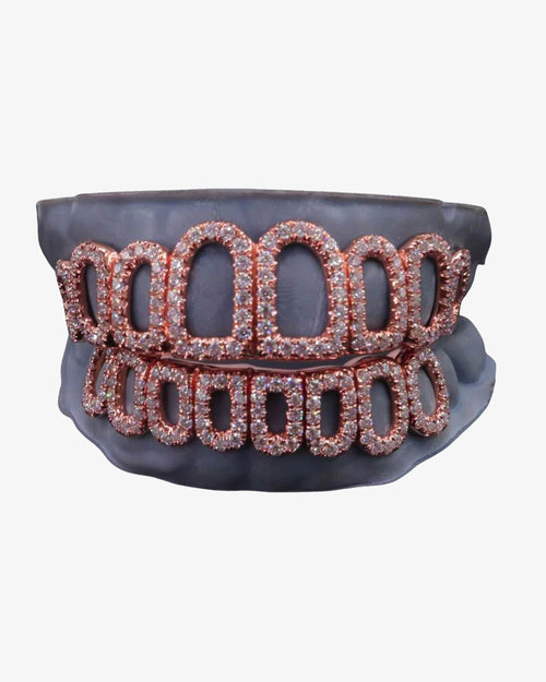 rose gold custom diamond open face grillz icecartel PX main