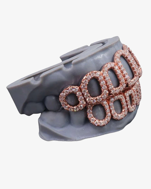 rose gold custom diamond open face grillz icecartel PX side