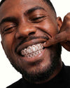 Rose Gold Open Face Custom Diamond Grillz - Rose Gold