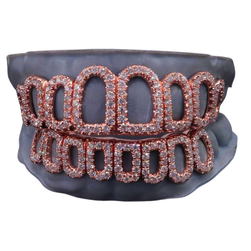 Rose Gold Custom Diamond open face grillz icecartel