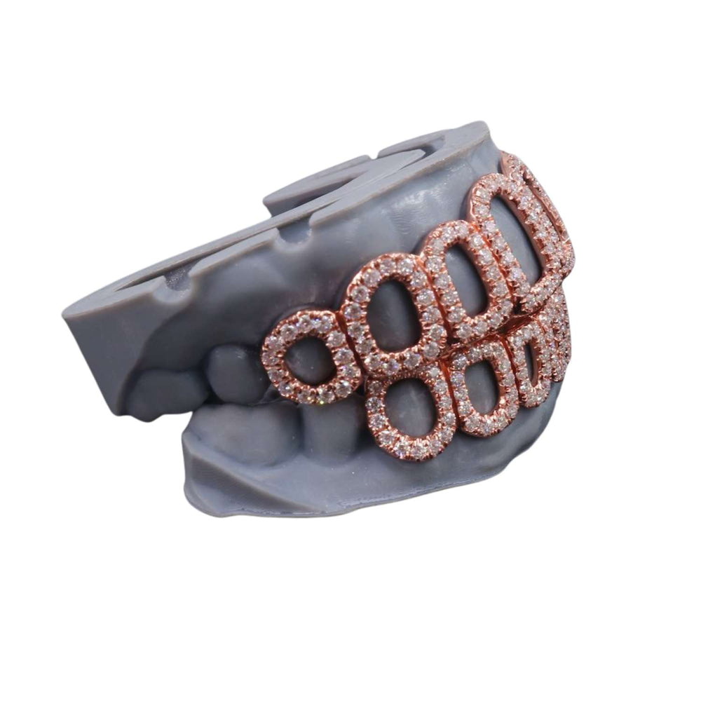 Rose Gold Custom Diamond open face grillz side icecartel