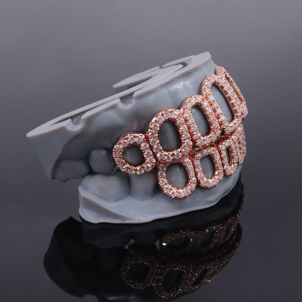 Rose Gold Custom Diamond open face grillz side