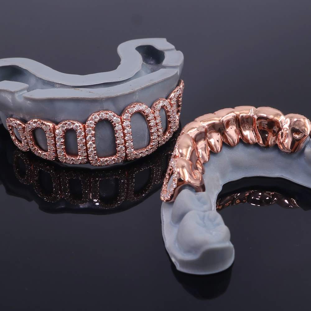 Rose Gold Custom Diamond open face grillz top and bottom