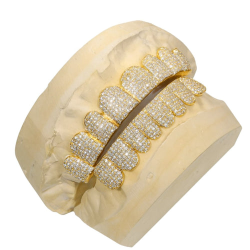 yellow gold custom moissanite grillz 14k gold side 2 icecartel