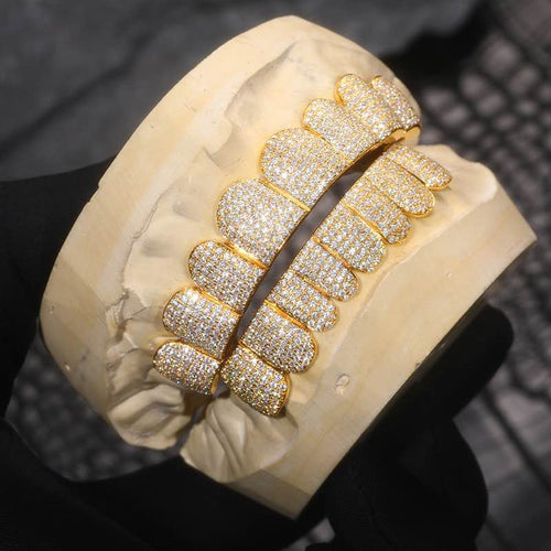 yellow gold custom moissanite grillz 14k gold side 2