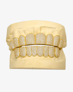 Custom Moissanite Diamond Grillz 14K Yellow Gold - 