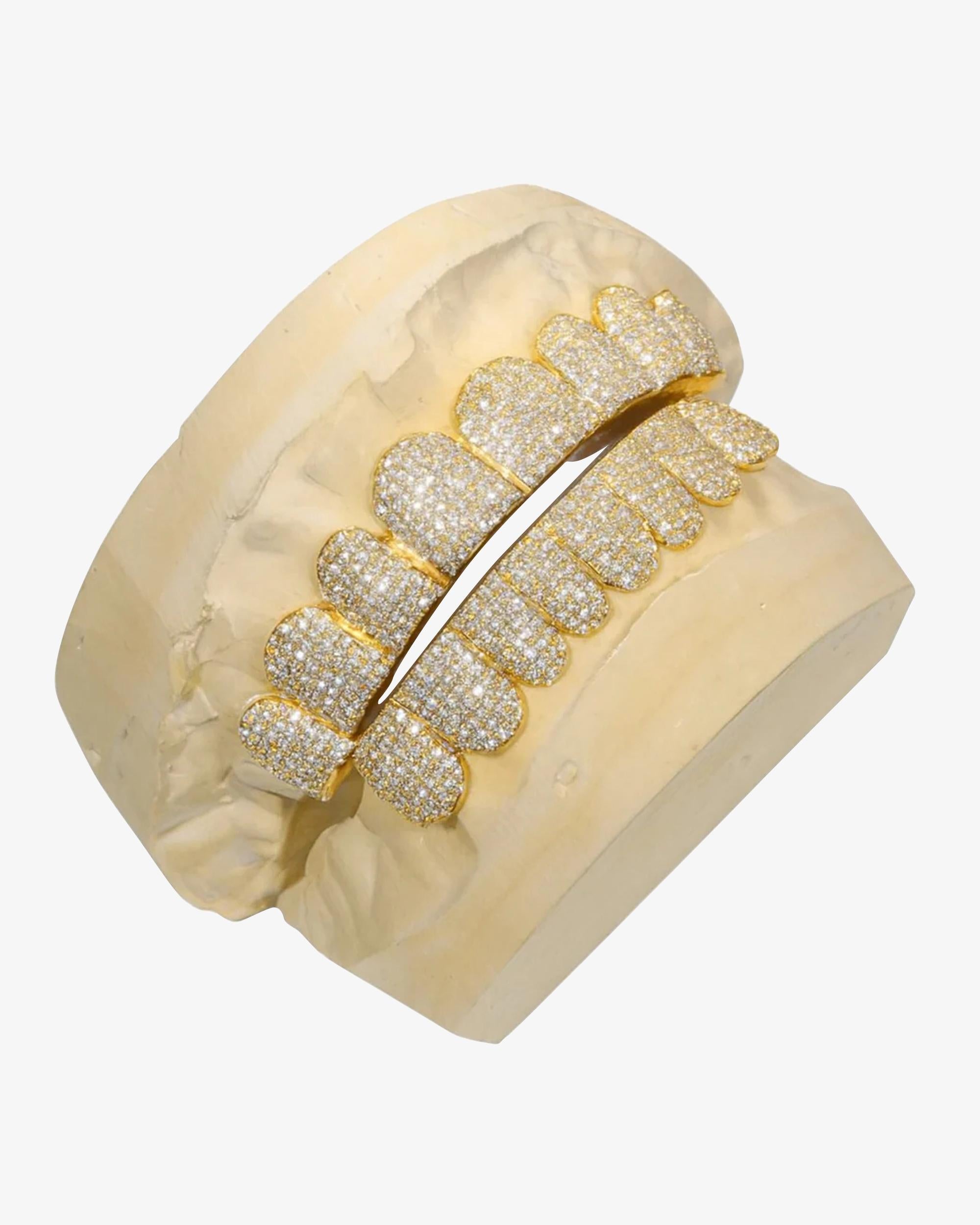 Custom Moissanite Diamond Grillz – 14K Yellow Gold
